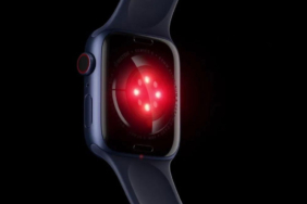 Apple Watch Series 12, özel bir kayışla geliyor