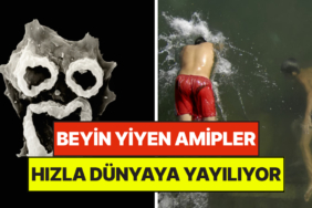 Uzmanlar Alarma Geçti: Beyin Yiyen Amip "Korku Filmi Gibi" Dünyaya Yayılıyor