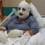 Kızını kurtarmak için alevlerin arasına girdi, kendisi de yandı