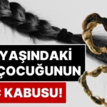 Nadir Görülen 'Rapunzel Sendromu' Ameliyat Gerektirecek Kadar Büyük Bir Saç Yumağına Neden Olabiliyor